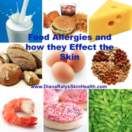 FOODS CAUSING SKIN PROBLEMS